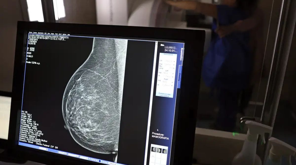 Mamografia