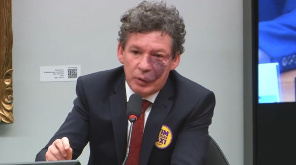 Reginaldo Lopes cita redução de afastamentos médicos e de custos previdenciários para defender o fim da escala 6x1 na CCJ da Câmara. (Foto: Reprodução/YouTube/Câmara dos Deputados)